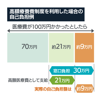 高額療養費制度利用の自己負担例